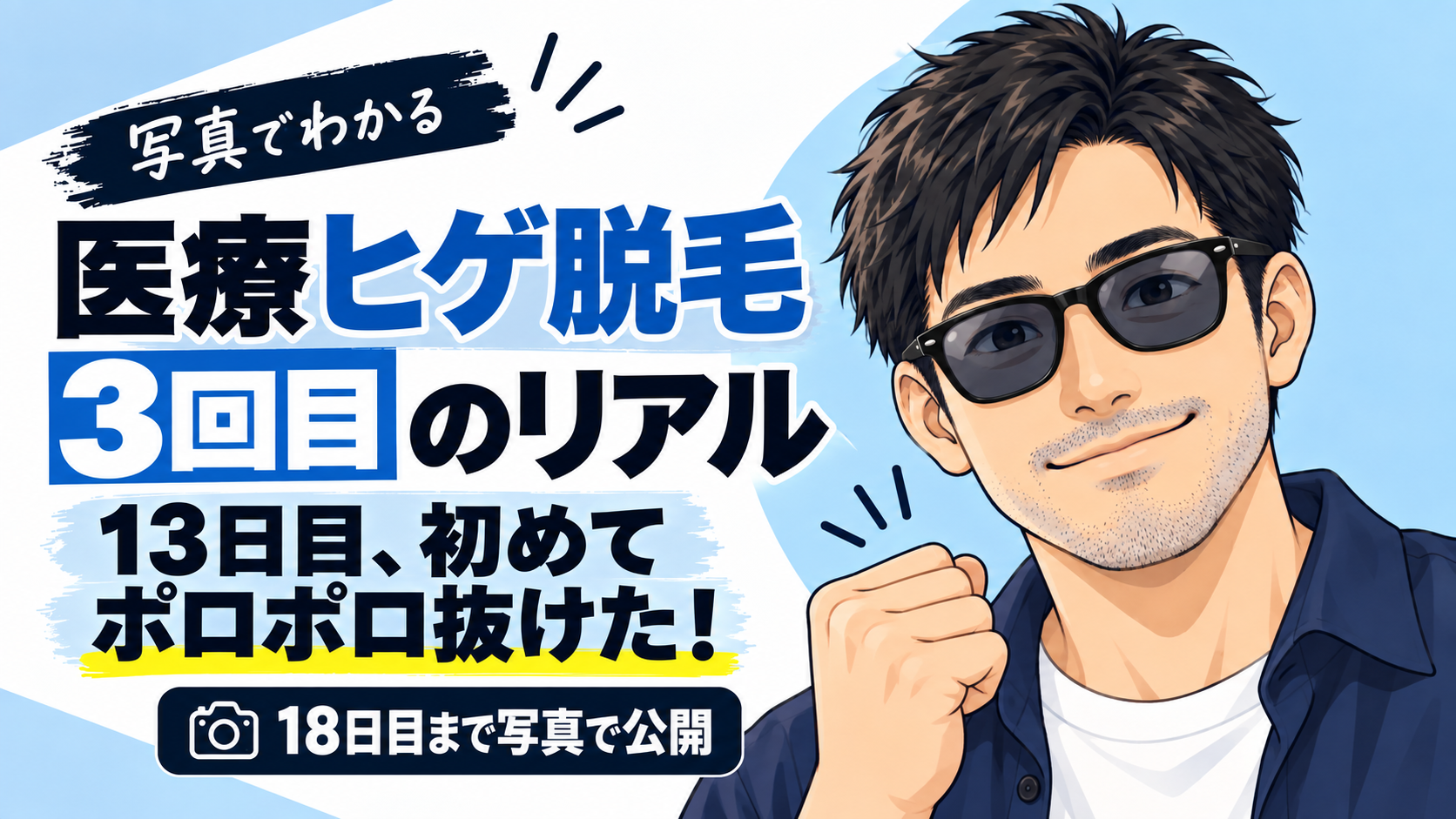 医療ヒゲ脱毛3回目の効果は？13日目に初めてポロポロ抜けた経過を写真で公開
