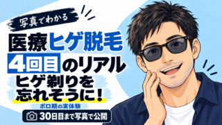 医療ヒゲ脱毛4回目の効果は？ヒゲ剃りを忘れそうになった経過を写真で公開
