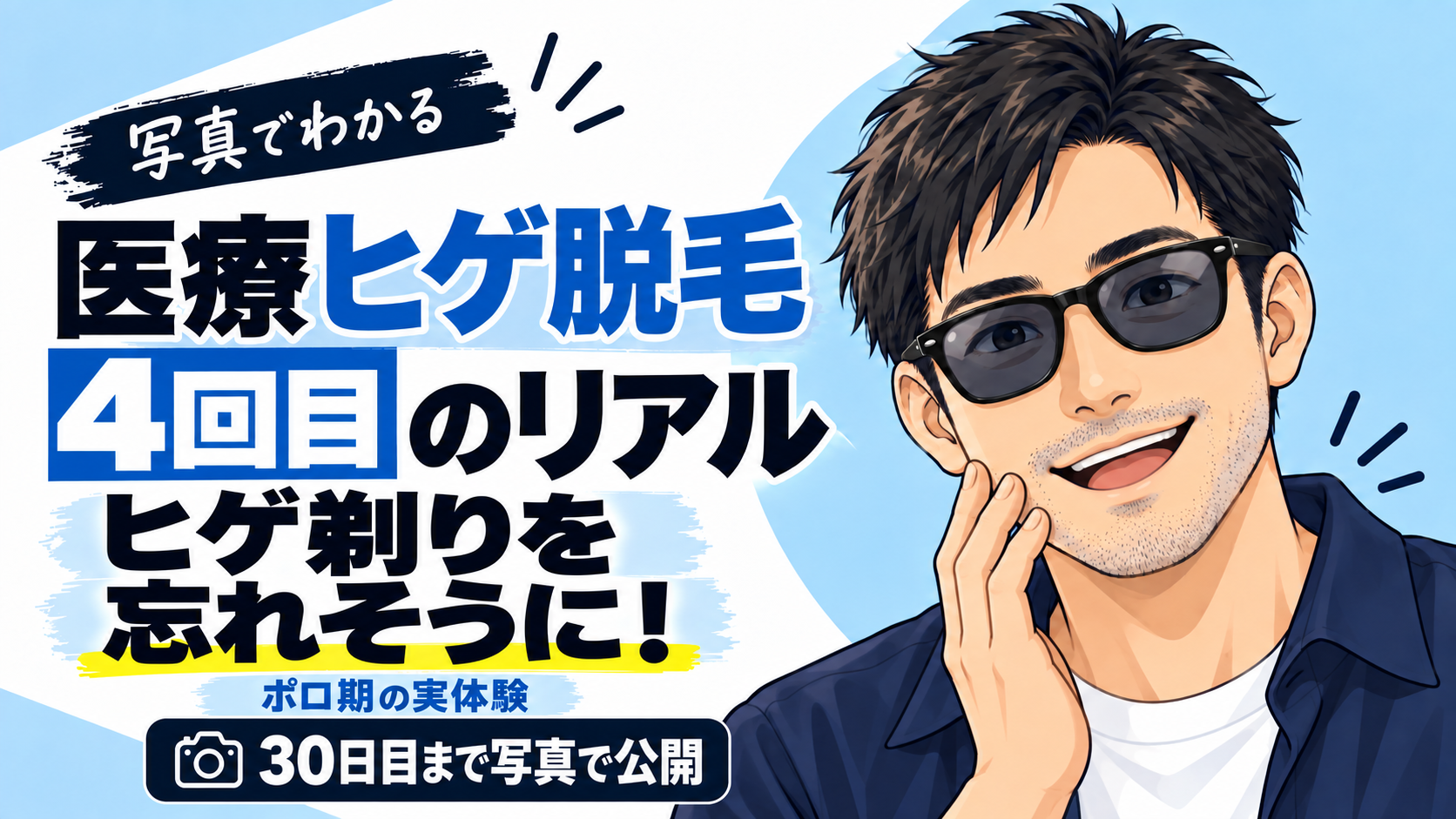医療ヒゲ脱毛4回目の効果は？ヒゲ剃りを忘れそうになった経過を写真で公開
